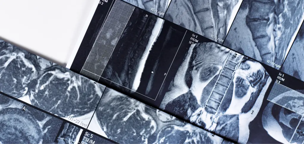 Trends Shaping Teleradiology in Outpatient Imaging Blog Banner